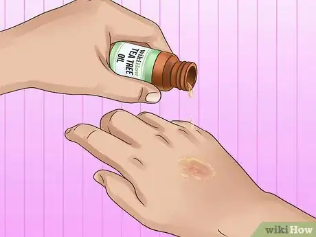 Image titled Control Microbial Growth Step 3