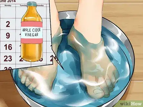 Image titled Heal Dry Skin on Your Feet Step 2