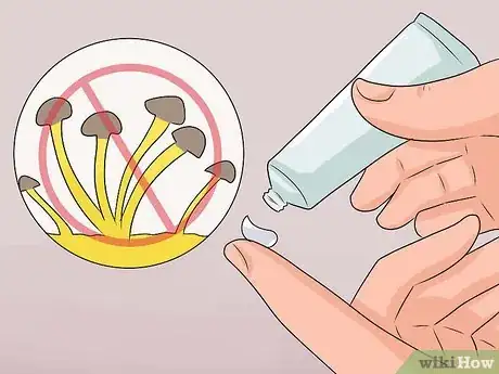 Image titled Treat Itchy Breasts Step 15