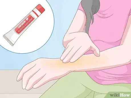 Image titled Use Herbs to Heal Step 12