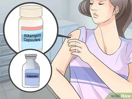 Image titled Prevent Acinetobacter Infection Step 10