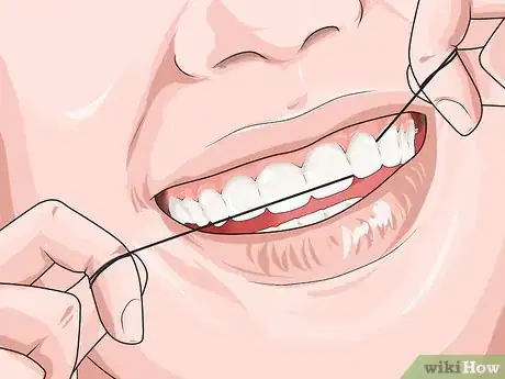 Image titled Prevent Actinomycosis Step 1