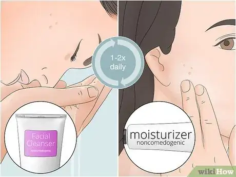 Image titled Clear Pustules on Your Face Step 5