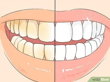 Image titled Prevent Tartar Step 13