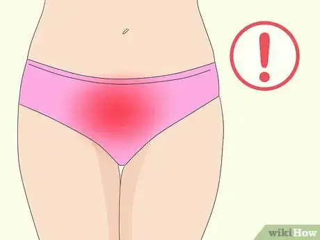 Image titled Use a Cervical Cap Step 14