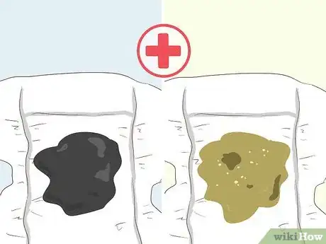 Image titled Treat Diarrhea in Infants Step 11