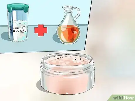 Image titled Heal Dry Skin on Your Feet Step 1