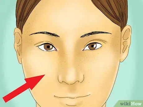 Image titled Get Rid of Blackheads and Whiteheads Using Commercial Products Step 1