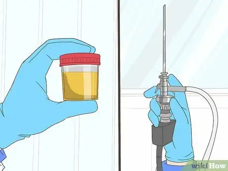 Image titled Treat Bladder Cancer Step 9