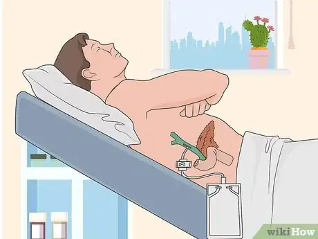 Image titled Treat Cholangitis Step 04