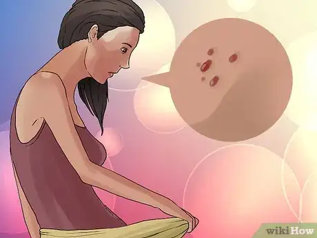 Image titled Become Pregnant With HPV Step 2