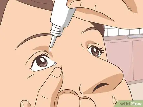 Image titled Protect Your Eyes in Winter Step 5