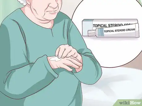 Image titled Handle a Rheumatoid Arthritis Skin Problem Step 24