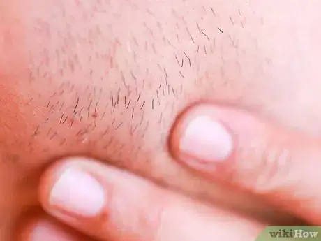 Image titled Shave With an Electric Shaver Step 5