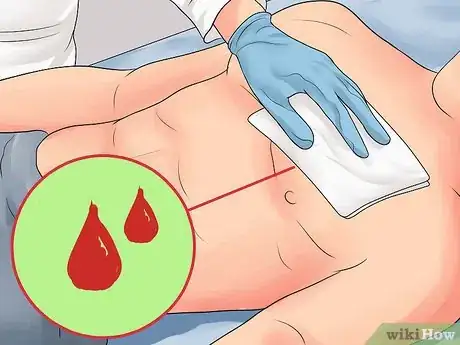 Image titled Stop Mild Bleeding During First Aid Step 3