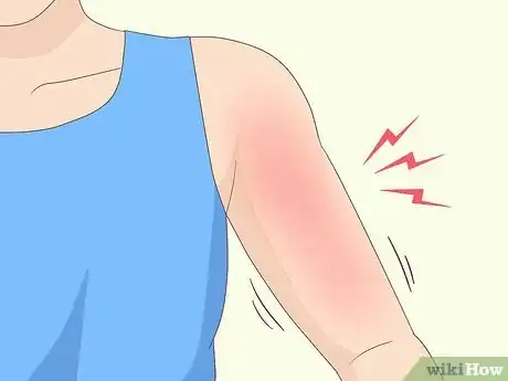 Image titled Identify a Rotator Cuff Injury Step 3