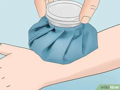 Image titled Treat Infected Insect Bites at Home Step 7