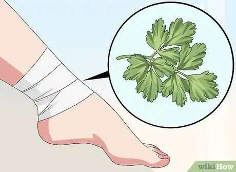 Image titled Heal a Bruise Step 9