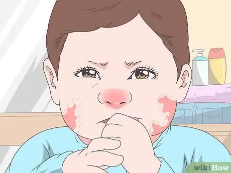 Image titled Diagnose Allergic Colitis in Babies Step 4