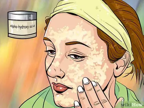 Image titled Erase Crow's Feet Step 3