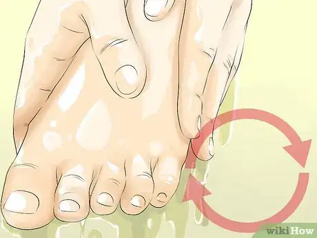 Image titled Heal Dry Skin on Your Feet Step 9