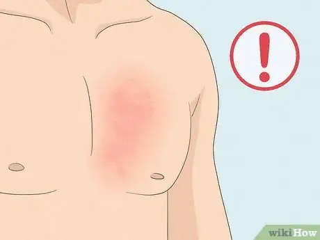 Image titled Is It Ok to Shave Chest Hair Step 4