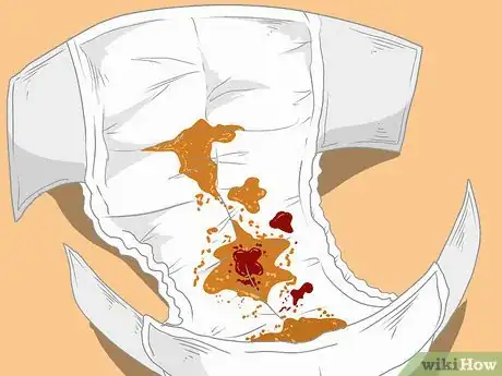 Image titled Diagnose Allergic Colitis in Babies Step 2