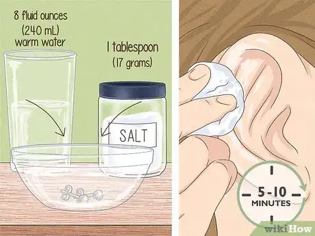 Image titled What Can You Use to Clean an Ear Piercing Step 2