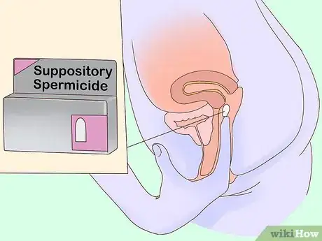 Image titled Use Spermicides Step 7