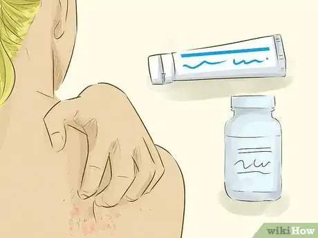 Image titled Care for a Person With Jaundice Step 5