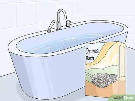 Image titled Treat Insect Bites in Toddlers Step 8