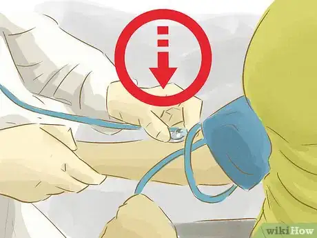 Image titled Treat an Aneurysm Step 4