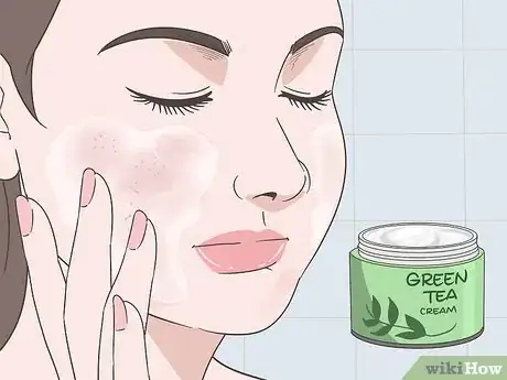 Image titled How to Treat Rosacea Can Herbal Remedies Help Step 4