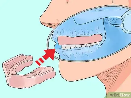 Image titled Reduce Concussion Risk for Wrestlers Step 2