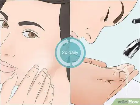 Image titled Wash an Acne Prone Face Step 7