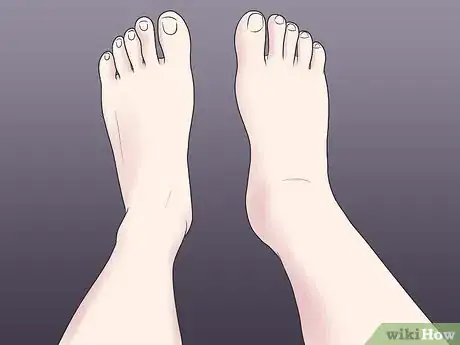 Image titled Treat a Broken Ankle Step 3