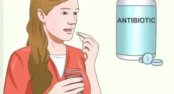 Treat Morgellon's Disease