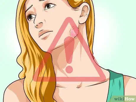 Image titled Prevent Actinomycosis Step 5