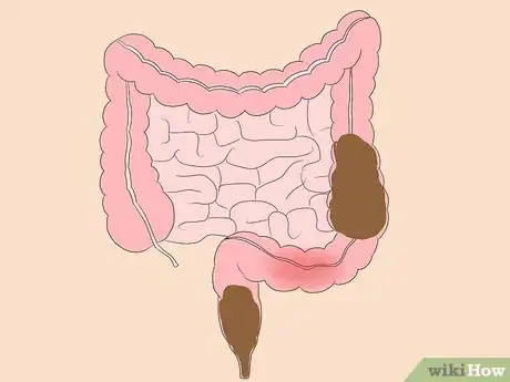 Image titled Take Isabgol Step 1