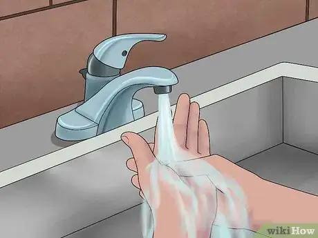 Image titled Stop Mild Bleeding During First Aid Step 1