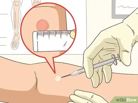 Image titled Treat Silicosis Step 4