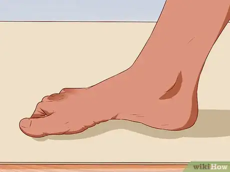 Image titled Relieve Bunions Step 8