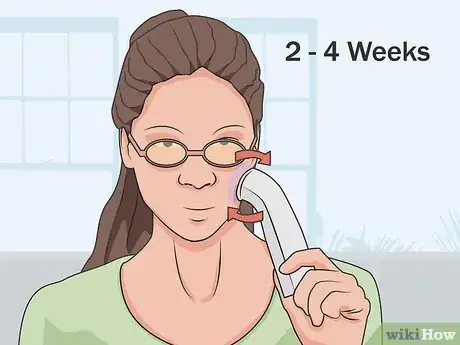 Image titled Use Blue Light Acne Treatment Step 09