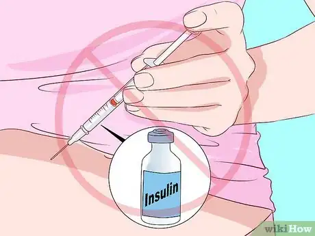 Image titled Prepare for a Kidney Biopsy Step 12