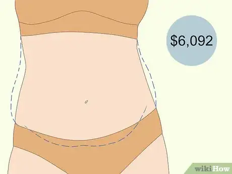 Image titled Have Plastic Surgery Step 10