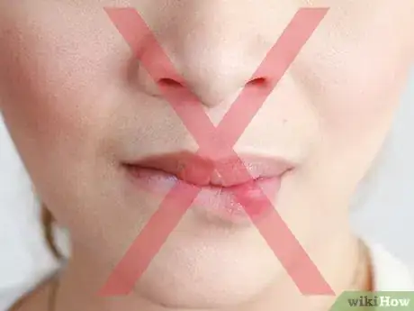 Image titled Avoid Lip Chapping During Winter Step 3
