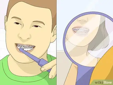 Image titled Wear Braces With Confidence and Style Step 5