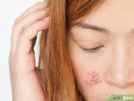 Image titled Get a Beautiful Complexion Step 25