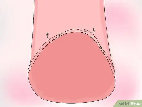 Image titled Make a High Low Shirt Step 14