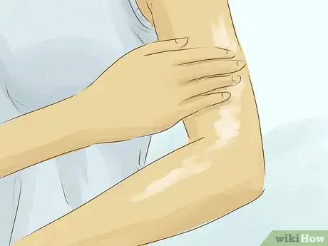 Image titled Be Pretty if You Are Unfortunate With Your Looks Step 15